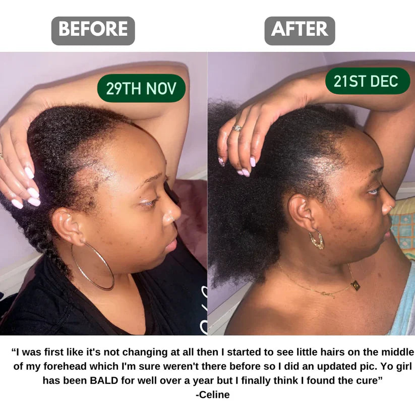 Batana Hair Growth Oil